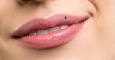 Nốt ruồi trên môi có ý nghĩa gì? Là điềm báo tốt hay xấu?