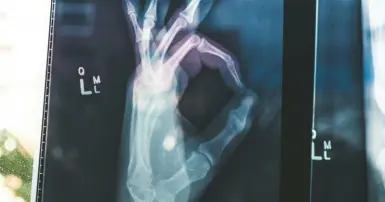 Google giới thiệu MedGemma và MedSigLIP: Cách mạng công nghệ y tế