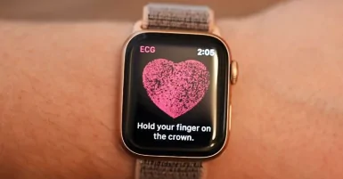 ECG là gì? Những đồng hồ thông minh có ECG HOT nhất hiện nay