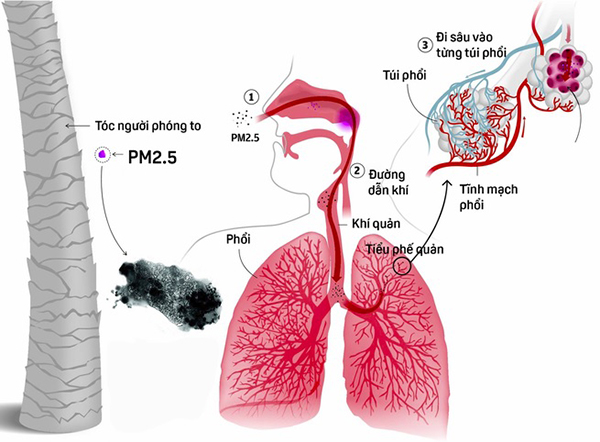 Bụi mịn PM2.5 và PM10 - Sát thủ vô hình dung của con cái người