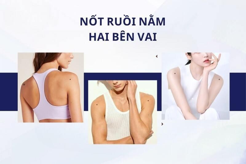 Nốt ruồi trên 2 vai