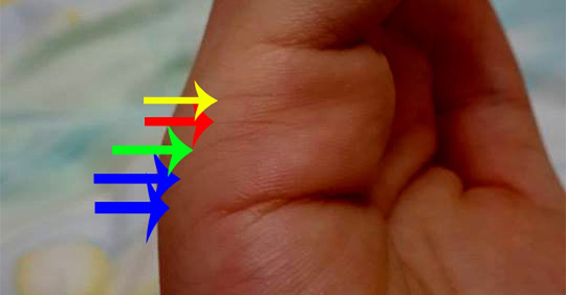 Đường chỉ tay hôn nhân biểu thị điều gì