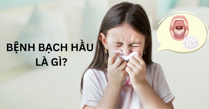 Bệnh bạch hầu là gì?