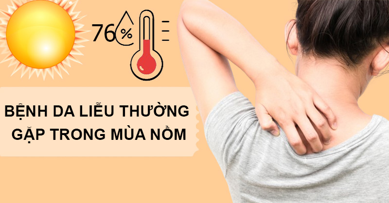 Bệnh da liễu thường gặp trong mùa nồm