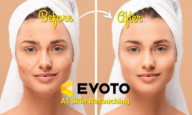 Lợi ích khi sử dụng Evoto AI