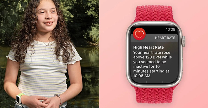 Apple Watch giúp phát hiện bệnh tim hiệu quả